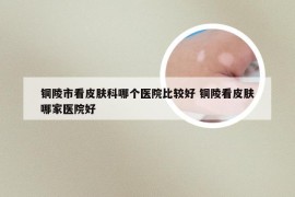 铜陵市看皮肤科哪个医院比较好 铜陵看皮肤哪家医院好