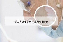 手上白斑咋会事 手上白斑是什么
