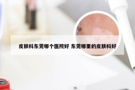 皮肤科东莞哪个医院好 东莞哪里的皮肤科好