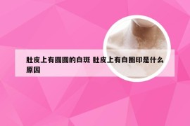 肚皮上有圆圆的白斑 肚皮上有白圈印是什么原因