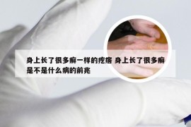 身上长了很多癣一样的疙瘩 身上长了很多癣是不是什么病的前兆