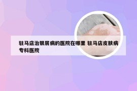 驻马店治银屑病的医院在哪里 驻马店皮肤病专科医院