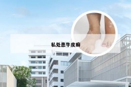 私处患牛皮癣