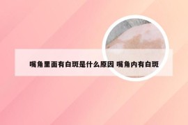 嘴角里面有白斑是什么原因 嘴角内有白斑