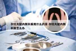 孕妇大腿内侧长癣用什么药膏 孕妇大腿内侧长藓怎么办