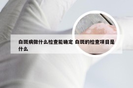 白斑病做什么检查能确定 白斑的检查项目是什么