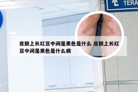 皮肤上长红豆中间是黑色是什么 皮肤上长红豆中间是黑色是什么病