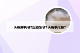 头癣用中药好还是西药好 头癣中药治疗