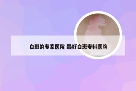 白斑的专家医院 最好白斑专科医院
