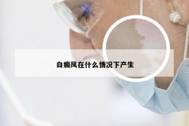 白癜风在什么情况下产生