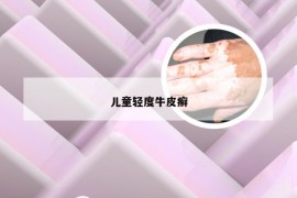 儿童轻度牛皮癣