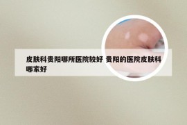 皮肤科贵阳哪所医院较好 贵阳的医院皮肤科哪家好