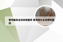 惠州最出名的皮肤医院 惠州有什么皮肤科医院