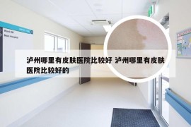 泸州哪里有皮肤医院比较好 泸州哪里有皮肤医院比较好的