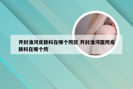 开封淮河皮肤科在哪个院区 开封淮河医院皮肤科在哪个院
