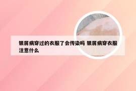 银屑病穿过的衣服了会传染吗 银屑病穿衣服注意什么