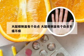 大腿根侧面有个白点 大腿根侧面有个白点不痛不痒