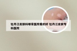 牡丹江皮肤科哪家医院看的好 牡丹江皮肤专科医院