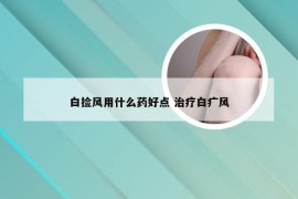 白捡风用什么药好点 治疗白疒风