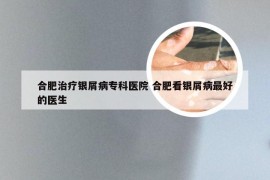 合肥治疗银屑病专科医院 合肥看银屑病最好的医生