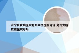 济宁皮肤病医院兖州大桥医院电话 兖州大桥皮肤医院好吗