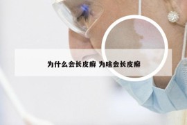 为什么会长皮癣 为啥会长皮癣