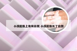 小孩屁股上有块白斑 小孩屁股长了白斑