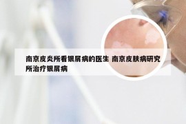 南京皮炎所看银屑病的医生 南京皮肤病研究所治疗银屑病