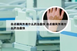 白点癫风外用什么药治最快 白点癫风外用什么药治最快