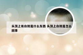 头顶上有白斑是什么东西 头顶上白斑是怎么回事