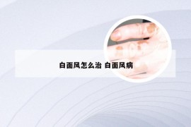 白面风怎么治 白面风病