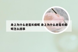 身上为什么老是长癣呢 身上为什么老是长癣呢怎么回事
