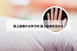 脸上起癣什么样子的 脸上起癣该怎么办