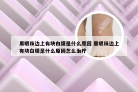 黑眼珠边上有块白膜是什么原因 黑眼珠边上有块白膜是什么原因怎么治疗