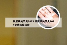 银屑病关节炎2023 银屑病关节炎2024免费临床试验
