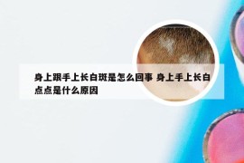 身上跟手上长白斑是怎么回事 身上手上长白点点是什么原因