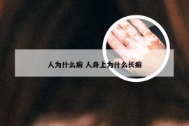 人为什么癣 人身上为什么长癣