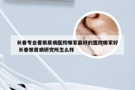长春专业看银屑病医院哪家最好的医院哪家好 长春银屑病研究所怎么样