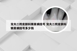 交大二院皮肤科银屑病挂号 交大二院皮肤科银屑病挂号多少钱