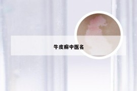 牛皮癣中医名
