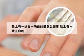 脸上有一块白一块白的是怎么回事 脸上有一块儿白的