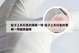 肚子上长红色的像癣一样 肚子上长红色的像癣一样越抓越痒