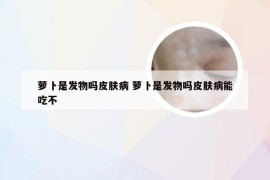 萝卜是发物吗皮肤病 萝卜是发物吗皮肤病能吃不