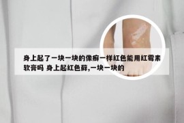 身上起了一块一块的像癣一样红色能用红霉素软膏吗 身上起红色藓,一块一块的