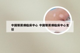 中国银屑病临床中心 中国银屑病临床中心主任