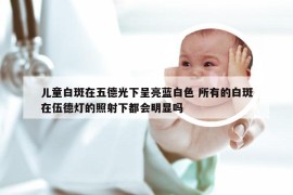 儿童白斑在五德光下呈亮蓝白色 所有的白斑在伍德灯的照射下都会明显吗
