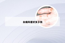 白癜风看好多少钱