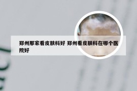 郑州那家看皮肤科好 郑州看皮肤科在哪个医院好