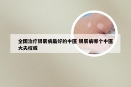 全国治疗银屑病最好的中医 银屑病哪个中医大夫权威