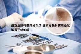 盛京皮肤科医院哈尔滨 盛京皮肤科医院哈尔滨是正规的吗
